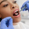 dentist checking a patient for cavities