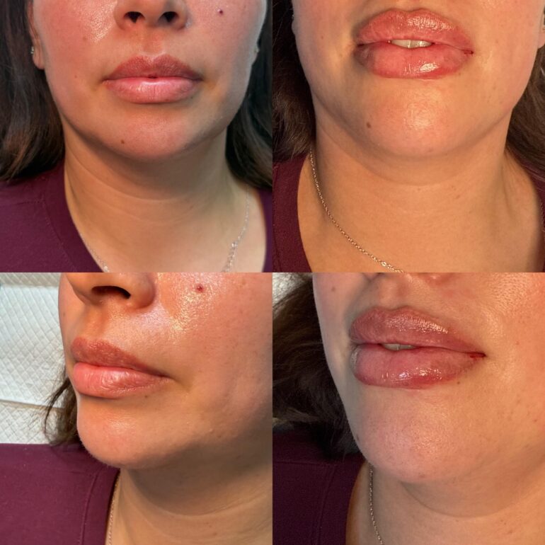The Art of Natural Transformation at Eternia Medspa